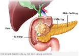 Dấu hiệu sớm ung thư tụy