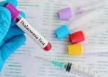 Phát hiện sớm và cách sàng lọc người mang gen bệnh Thalassemia (tan máu bẩm sinh)