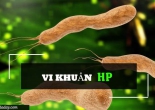 Phác đồ điều trị vi khuẩn HP dạ dày mới nhất của Bộ Y tế
