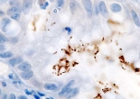 Phát hiện về “vũ khí bí mật” của Helicobacter pylori