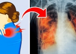 5 dấu hiệu cảnh báo phổi của bạn đang gặp vấn đề