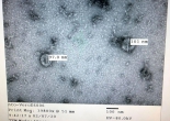 Việt Nam nuôi cấy và phân lập thành công virus corona mới